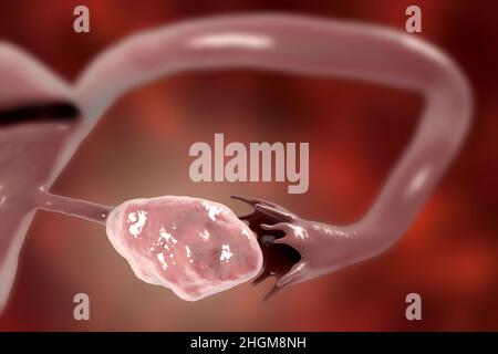 Healthy ovary and fallopian tube, illustration Stock Photo