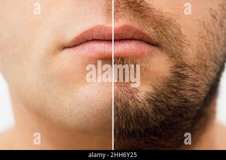 A man with a qr code on his forehead. The man looks at his QR code on his head. Global Control and Governance Population Chipping Concept Stock Photo