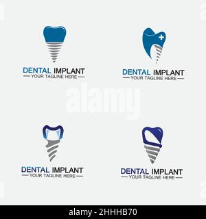 Set Dental implant logo vector  designs concept ,  Dental Clinic &Care logo template Stock Vector