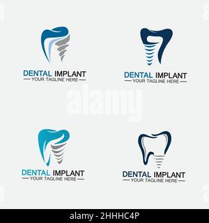 Set Dental implant logo vector  designs concept ,  Dental Clinic &Care logo template Stock Vector