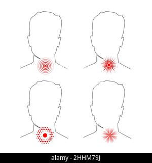 Sore throat vector illustration. Abstract outline human body and head with pain location on neck of different red circle line symbols, silhouette of t Stock Vector