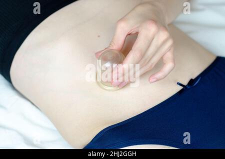 A woman makes herself a canned vacuum massage of the abdomen. Massage the abdomen with vacuum cups. Body care Stock Photo