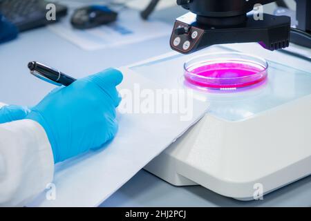 Close up scientist in rubber gloves making notes of the microbiological experiment. Petri dish with the sample is under microscope Stock Photo