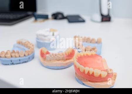 Dentures on a white background. Close-up of dentures. Full removable plastic denture of the jaws. Prosthetic dentistry. False teeth. Close-up of Stock Photo
