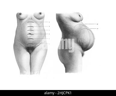 a, Frontal and B, right lateral view at 24 months post partum after