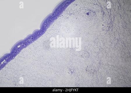 Staphylococcus epidermis as viewed under a light microscope Stock Photo