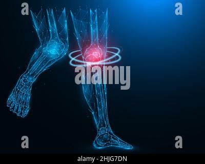 Polygonal vector illustration of an inflamed human kidney on a dark ...