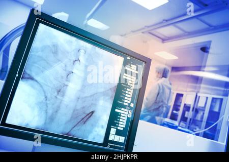 X-ray monitoring of surgical procedure in the hospital cathlab. Stock Photo