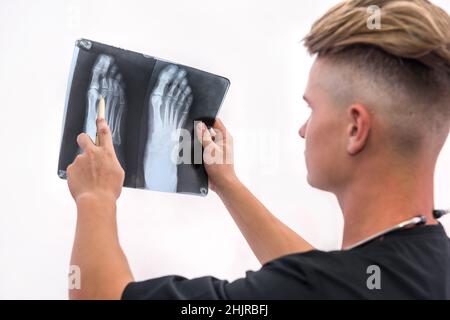 Handsome and young doctor holding foot x-ray of a patient . Medical help concept Stock Photo