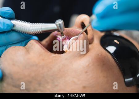 Dentist doing teeth cleaning procedure for male patient. Professional dental hygiene Stock Photo