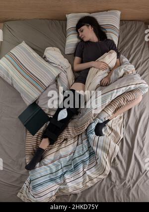 Young woman resting in bed after an ACL surgery.  picture from above. Stock Photo