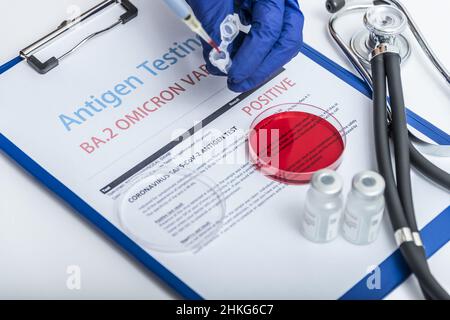 COVID-19 swab collection kit in doctor hands, nurse in personal protective equipment suit holds tube of coronavirus PCR test. Concept of corona virus Stock Photo