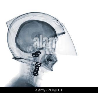 Person wearing a motorcycle helmet, X-ray Stock Photo