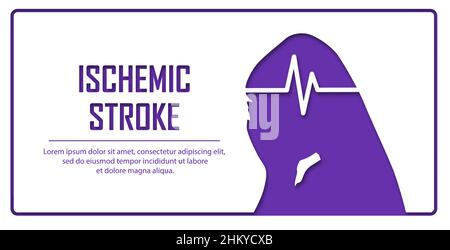 People suffering from ischemic stroke. Ischemic stroke patient concept. Medical help. People silhouette in paper cut style. Stroke types poster, banne Stock Vector