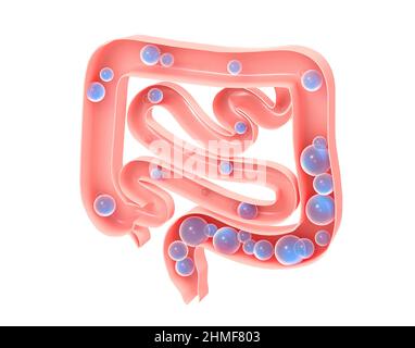 Anatomical 3d illustration of the large and small intestine with gas. Showing the open interior and the evolution of flatulence formation. Aerophagia. Stock Photo