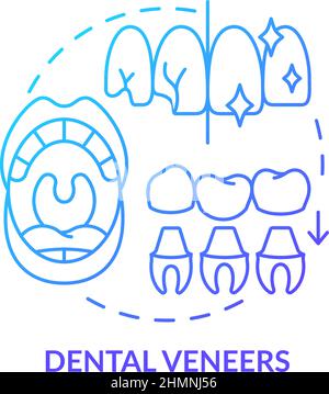 Dental veneers blue gradient concept icon Stock Vector