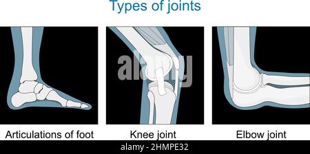 Types of joints. Knee joint, Articulations of foot, Elbow joint. Set icons. black and white. Flat vector illustration. Stock Vector
