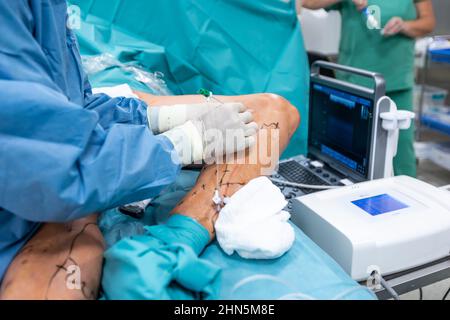 Process of varicose vein surgery in hospital, operating room, vein sealing, venous vascular surgery concept Stock Photo