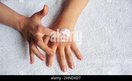 Red spots on the skin of the child's hands.children's allergy.selective focus Stock Photo