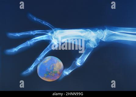 X-ray medical scan of human hand holding world globe. Europe and Middle East showing. War, global warming, oil. World crisis. Planet climate change Stock Photo