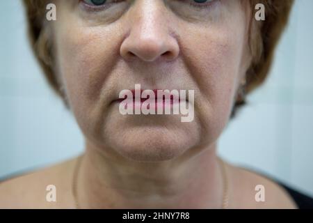 An adult Caucasian woman with blond short hair, a lancy jacket against the background of white tiles. At the reception at the cosmetologist before the Stock Photo