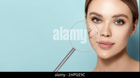 Female face with dry facial skin showing dehydrated and dry skin with magnifying glass on blue background. Cracked dry skin without moistening Stock Photo