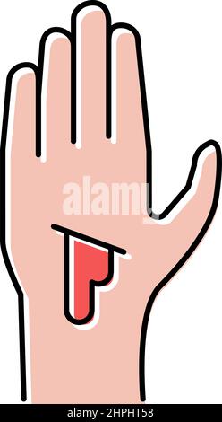 vector illustration of a Arterial and venous bleeding Stock Vector ...