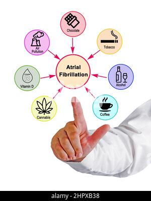 Seven Causes of Atrial Fibrillation Stock Photo