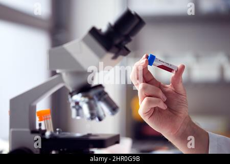 Close Up Of Male Lab Worker Or Phlebotomist Analysing Blood Samples In Laboratory With Microscope Stock Photo