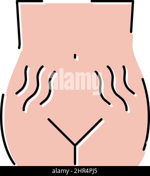 stretch marks on skin disease line icon vector illustration Stock ...
