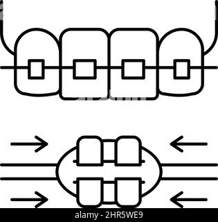 Tooth braces process icon. Outline tooth braces process vector icon ...