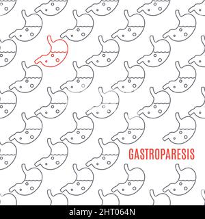 Gastroparesis, conceptual illustration Stock Photo