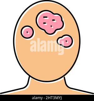 seborrhoeic dermatitis skin disease color icon vector illustration Stock Vector