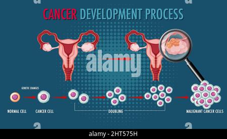 Cancer development process infographic  illustration Stock Vector