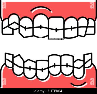 correction tooth braces color icon vector illustration Stock Vector