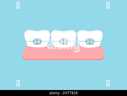 Tooth Braces Icon, Braces Vector Art Illustration Stock Vector Image ...