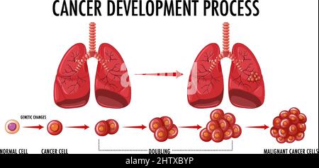 Cancer development process infographic illustration Stock Vector