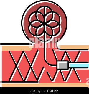 spine stabilization and reconstruction color icon vector illustration ...