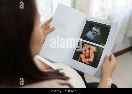 Asian young pregnant female looking cute pregnant belly and x ray ultrasound scan of baby. motherhood concept third trimester, x-ray pregnant. Stock Photo