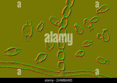 Coccidioidomycosis fungus, illustration Stock Photo