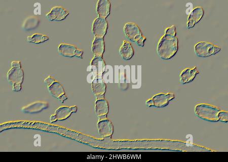 Coccidioidomycosis fungus, illustration Stock Photo - Alamy