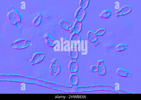 Coccidioidomycosis fungus, illustration Stock Photo