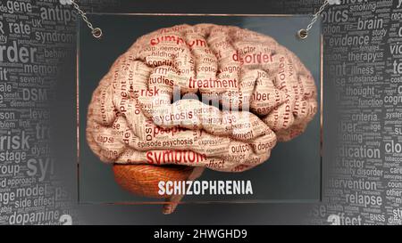 Schizophrenia anatomy - its causes and effects projected on a human brain revealing Schizophrenia complexity and relation to human mind. Concept art, Stock Photo