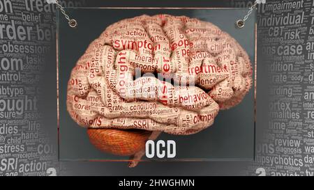 Ocd anatomy - its causes and effects presented as an exhibit of a brain with a word cloud of Ocd symptoms and problems revealing its complexity and re Stock Photo