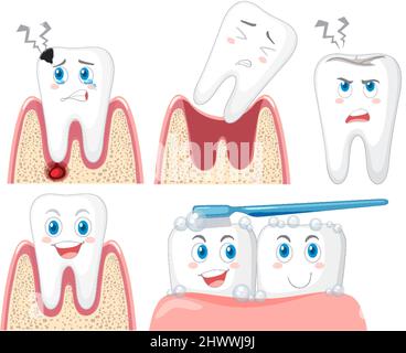 Set of all types of teeth on white background illustration Stock Vector