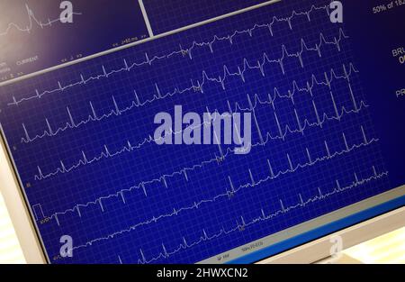 ECG screen read out Stock Photo - Alamy