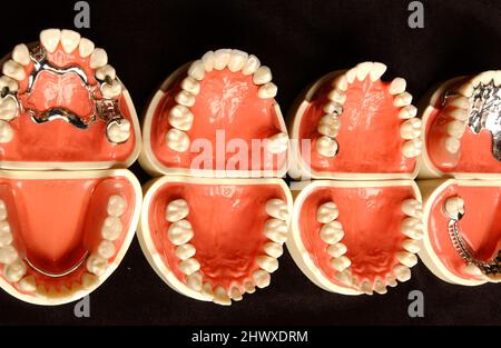 Three sets of full dentures. Dentures or false teeth are made from an acrylic base on which acrylic or ceramic teeth are mounted. Dentures are custom Stock Photo