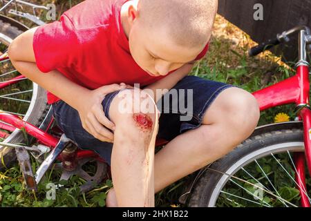 Broken wounded knee child. European boy in red T-shirt and denim shorts fell off bike and looks at wound abrasion. Children's summer holidays Stock Photo