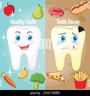 Infographic of healthy tooth and tooth decay illustration Stock Vector ...