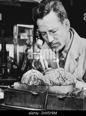 Army Doctor Studies Lye's Brian - Major Webb Haymaker, Neuropathologist of the Army Institute of Pathlogy, conducts post-mortem examination of brain of Dr. Robert Ley, Nazi leader who committed suicide. The Brain was flown to the U.S. from Germany for the examination, which disclosed that Ley had a long-standing disease of the brain 'sufficient..... to have impaired (his) mental and emotional faculties.' January 17, 1946. (Photo by AP Wirephoto).;Army Doctor Studies Lye's Brian - Major Webb Hay Stock Photo